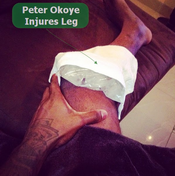 Peter Okoye Broken Leg