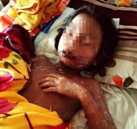 11 year Girl Suffers From Rare Skin Condition Allegedly Caused By Soft Drink