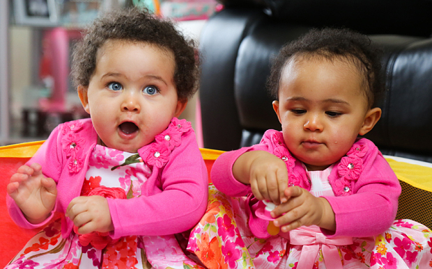 Identical sisters Amelia (right) and Jasmine - who have different skin an eye colour. See SWNS story SWTWINS; A mum has told how her one-year-old daughters get mistaken for step-sisters ‚Äì despite the fact they‚Äôre identical twins. During her pregnancy, Libby Appleby, 37, and her partner Tafadzwa Madzimbamuto, 40, were warned their twins would look so alike they would need to ‚Äòmark them with ink‚Äô to tell them apart. So they were shocked when their twins arrived in February 2015 - with contrasting skin tones. While elder twin Amelia has dark skin, black hair and brown eyes, her sister Jasmine has fair skin, blue eyes and mousey curls. Full-time mum Libby says: ‚ÄúWe were flabbergasted, even the doctors couldn‚Äôt believe it. ‚ÄúThey look like they‚Äôre different races.
