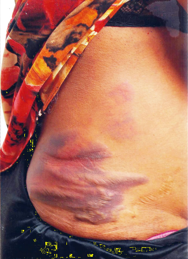 Olasunkanmi’s-body