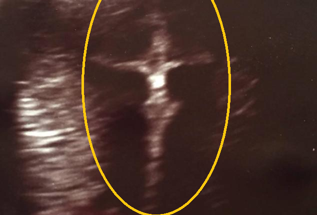 divine images in woman's womb