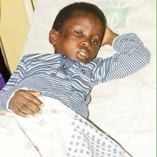 Ogun-First-Lady-Visits-Boy-Chained-04