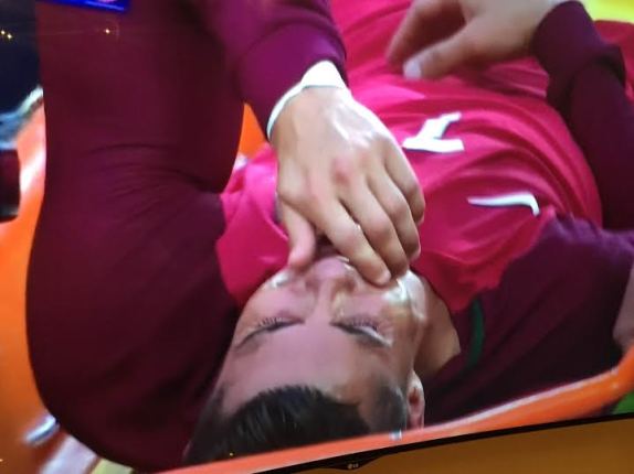 Cristiano Ronaldo weeps as he is stretchered off During First Half 