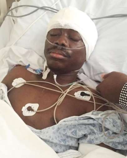Julius Agwu after the surgery 
