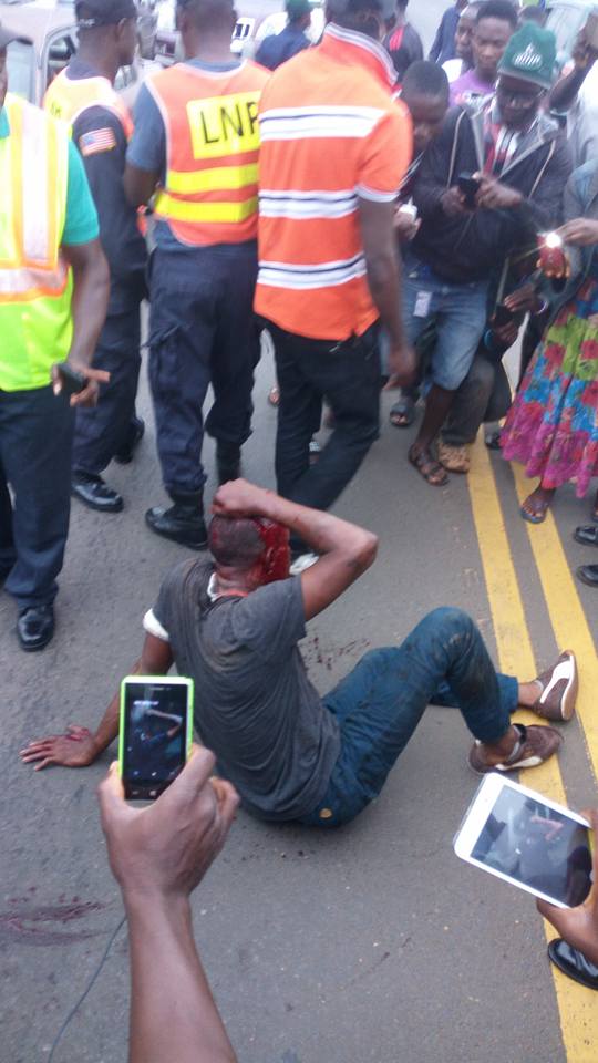 Nigerian guy beaten in Liberia2
