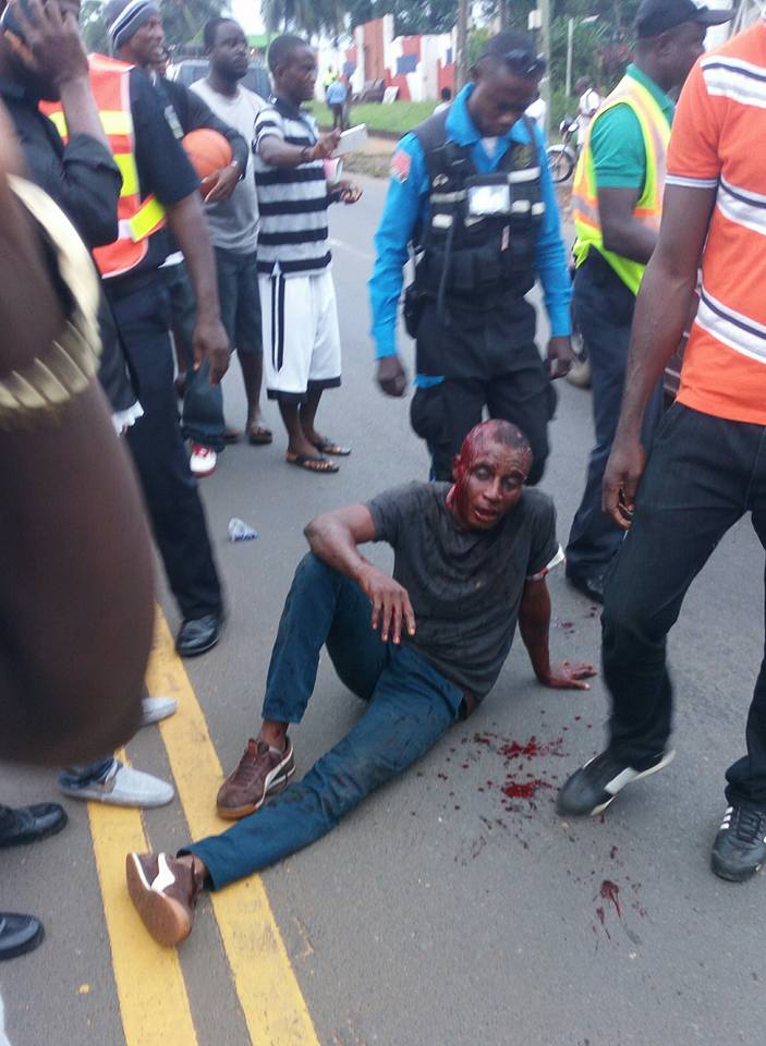 Nigerian guy beaten in Liberia7