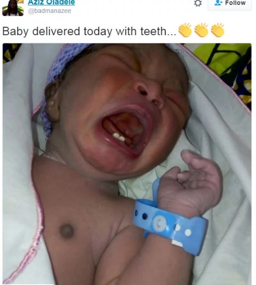 baby-teeth