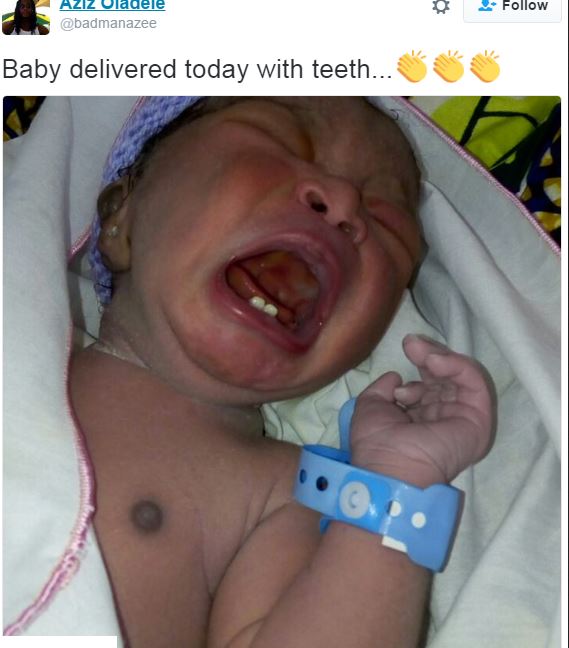 born-with-teeth