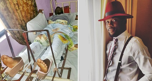 man paralyzed after visiting edo