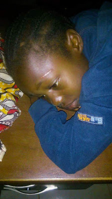 10 year old girl's buttocks burnt