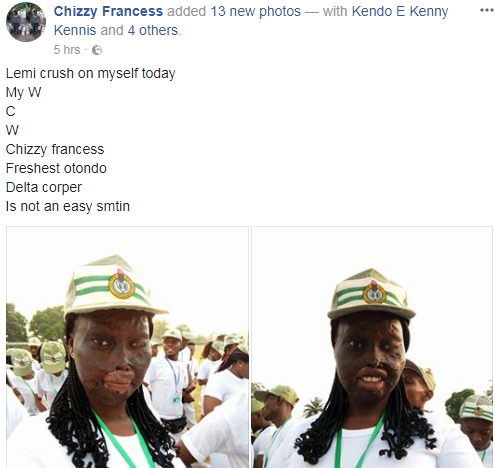 Burn Survivor Attacked