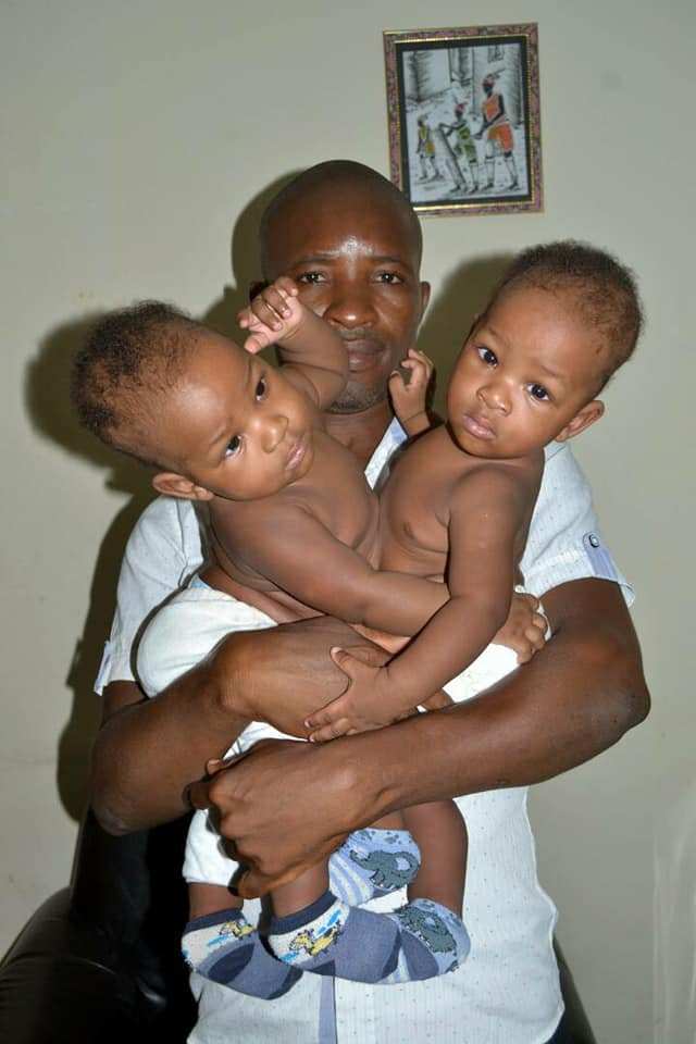 Nigerian conjoined Twins finally gets separated
