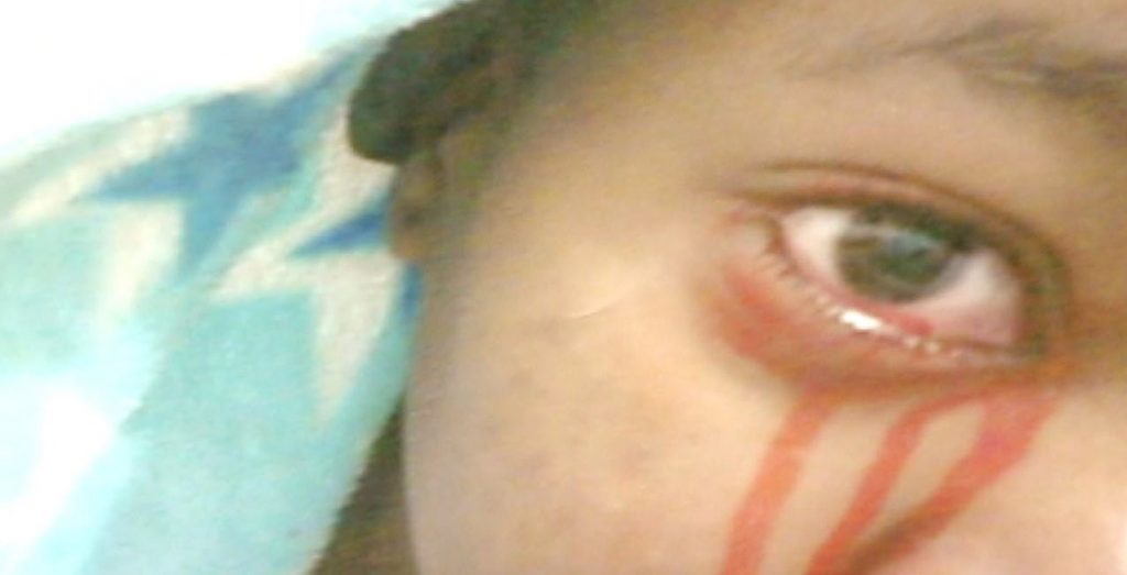 Girl Who Cries Blood Delivered Of Demons At TB Joshua's Church. (Photos