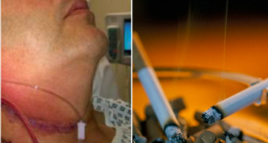 throat cancer patient kills colleague