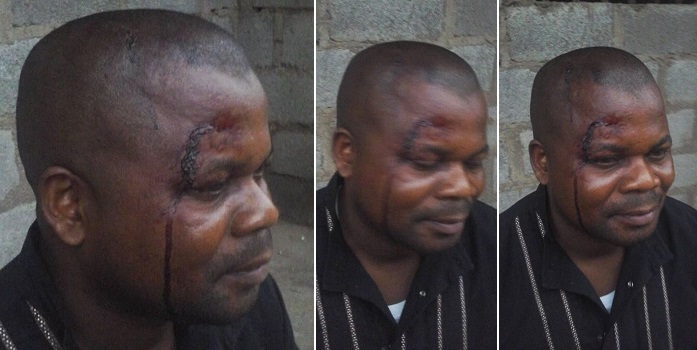 Robbers shot me twice, but God stopped the bullets from entering my body — This Nigerian man says