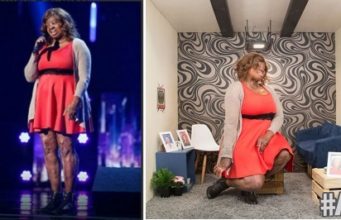 burn survivor kechi okwuchi