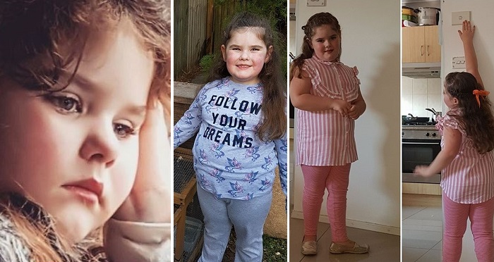 5 Year Old Girl Grew Breasts At 2, Started Her Period At 4 And Is Going Through Menopause Now At Age 5. (Photos)