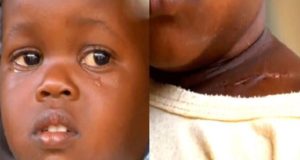 Survives Gunshot Wounds