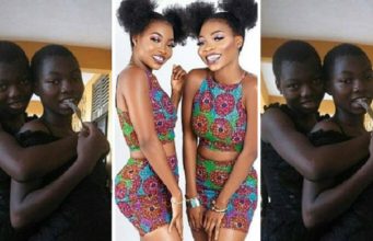 twins' transformation pictures