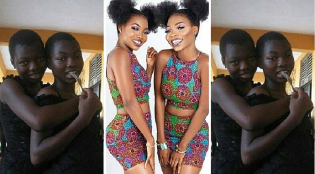 twins-black-transforms-white twins' transformation pictures