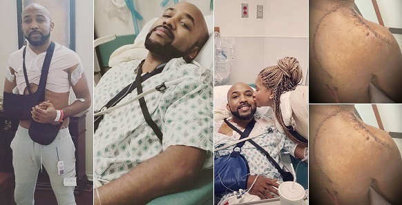 Banky W undergoes third cancer surgery