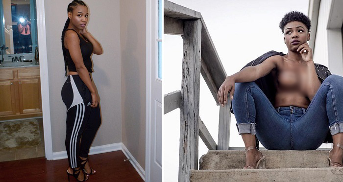 Read How This 24 Year Old Lady Survived Breast Cancer. (Photo)