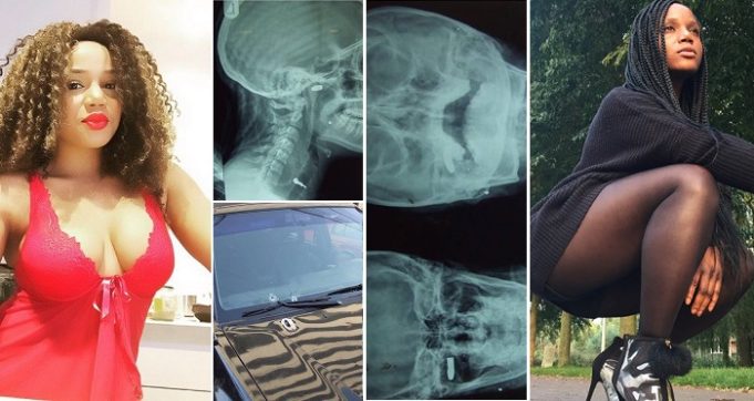 Maheeda Shares Touching Story