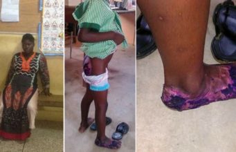 Pregnant Ghanaian Lady Dumps 5-Year-old Step-Daughter Inside Hot Water
