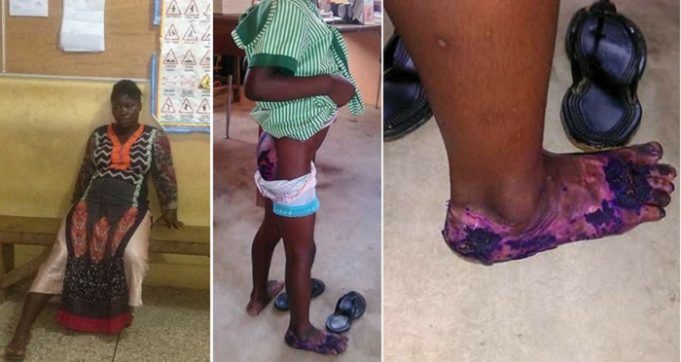 Pregnant Ghanaian Lady Dumps 5-Year-old Step-Daughter Inside Hot Water