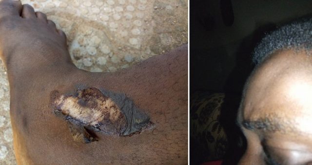 sars-free1 Man Narrates Ordeal