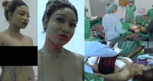 Tonto Dikeh undergoes cosmetic surgery