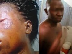 Wife pours hot water on lady for having anal sex with her husband