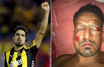 Former Argentine Footballer Lucas Viatri Severely Wounded