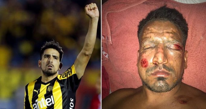 Former Argentine Footballer Lucas Viatri Severely Wounded