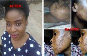 Gospel singer healed