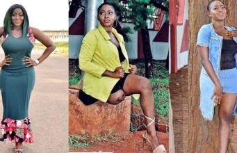Beautiful Nigerian amputee