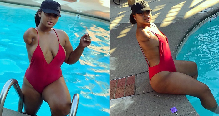 Beautiful amputee flaunts her stunning bod in revealing bikini (Photos)