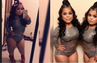 Beautiful Dwarf shows