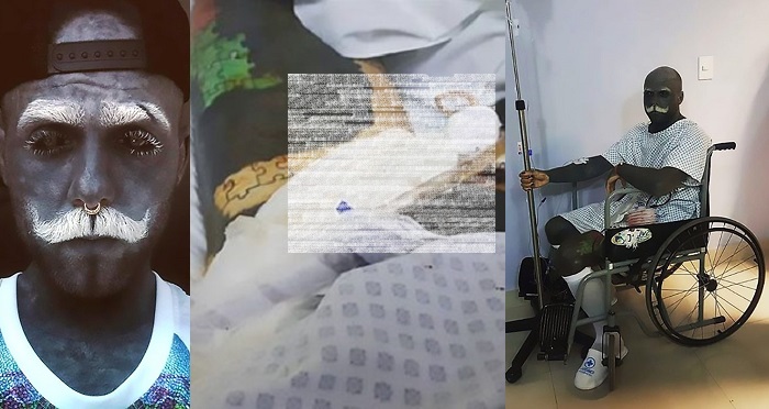 Tattoo addict removes penis because it interferes with his ‘look’