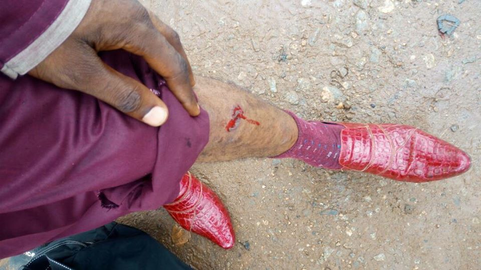 Pastor Survives Accident