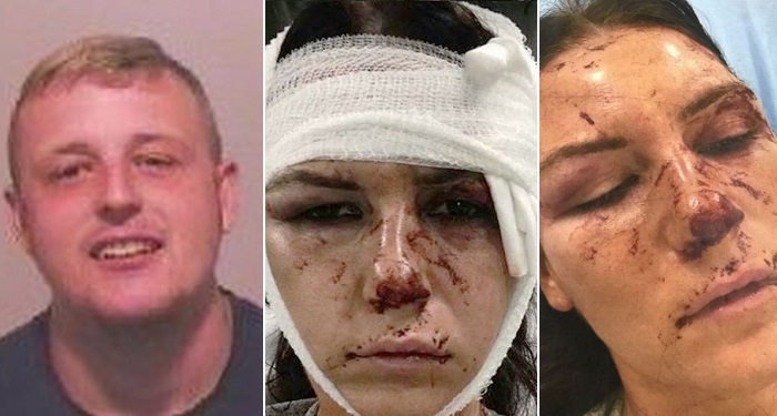 Man Jailed For 28 Months After He Savagely Beat His Ex-Girlfriend To A Pulp For Breaking Up With Him