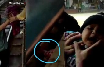 1-year-old baby miraculously survives