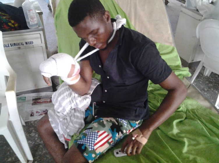UNIUYO student loses his fingers to fireworks