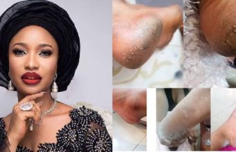 Actress Tonto Dikeh narrates the lingering battle between her feet and harmattan Actress Tonto Dikeh narrates