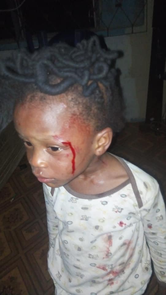 2-year-old girl brutalized