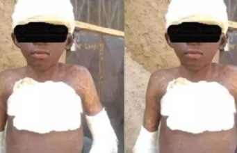 Man sets 11-year-old boy on fire for peeping at a woman in a bathroom