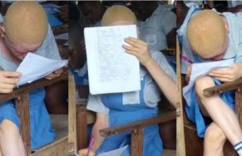 Youth corper seeks help for her female albino student