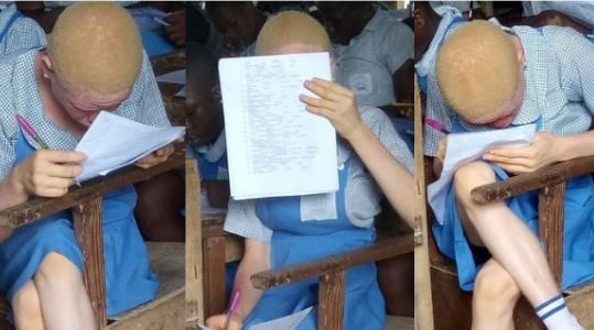Youth corper seeks help for her female albino student