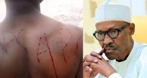 Man bleeds after tattooing APC into his skin