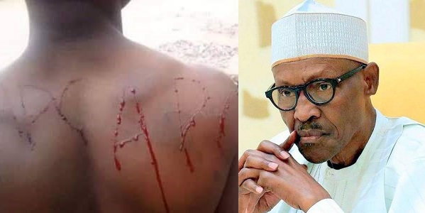 Man bleeds after tattooing APC into his skin